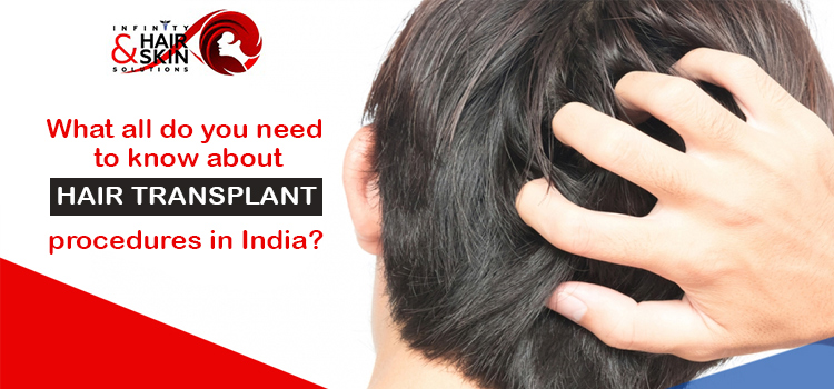 What all do you need to know about hair transplant procedures in India?