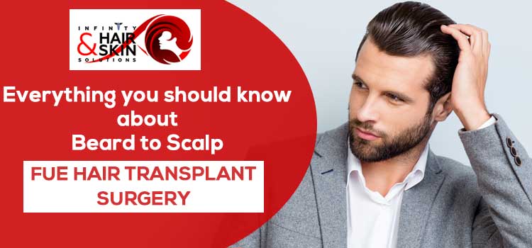 Everything you should know about Beard to Scalp FUE hair transplant surgery