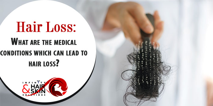 Hair loss What are the medical conditions which can lead to hair loss