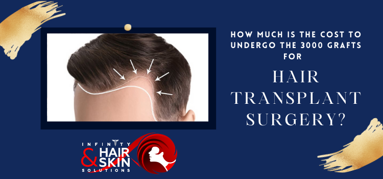 How much is the cost to undergo the 3000 grafts for hair transplant surgery?