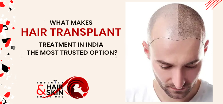 What makes hair transplant treatment in India the most trusted option?